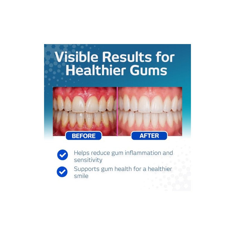Vitis Gingival Collut 500ml