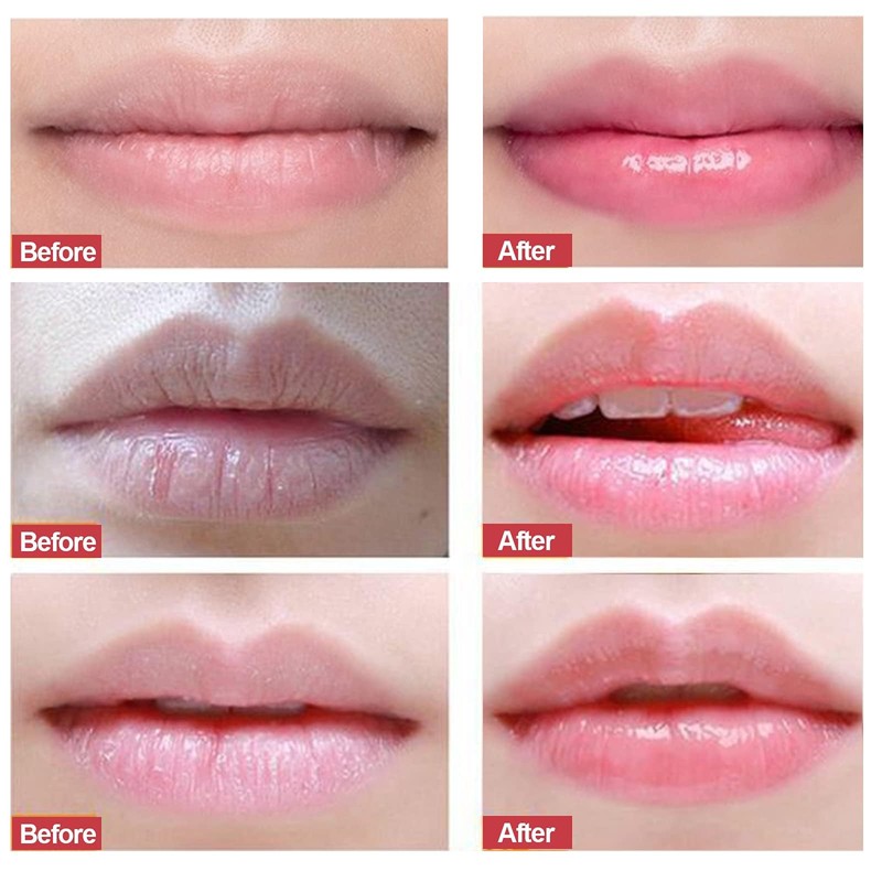 Strawberry Lip Scrub & Repair, Exfoliator & Moisturizer for Chapped,