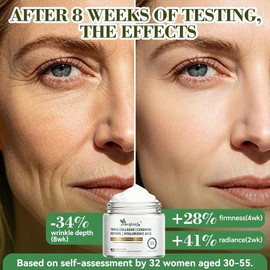 Retinol Cream, Anti-Aging Face Moisturizer, Anti-Wrinkle, Smooth Fine Lines, Hydrating, Collagen, Hyaluronic Acid, Day and Night Skin Care, Suitable for Face and Neck -Made in USA-1.7 fl oz