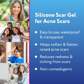 ScarAway Acne Scar Treatment, Clear Silicone Scar Gel, 100% Medical-Grade, Helps Improve Size, Color & Texture of Post-Acne Hypertrophic & Keloid Scars on Face & Body, Water Resistant, 15 grams