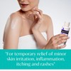 Aquanil HC Lotion, Calming Body Lotion, Anti-Itch Formula, Ideal for