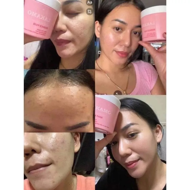 LAKAMO Pore Tightening Essence Pads សំឡីជូតមុខកូរ៉