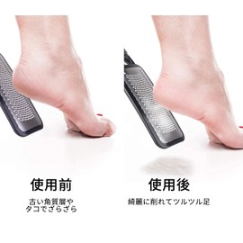 FOLAI Foot File Callus Remover Stainless Steel Hanging Type Callus Removal Callus Elimination Scraping Professional Foot File Safe and Efficient Micro Cutter Heel Clean Travel For Dry and Wet Feet