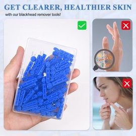 Lishae Acne Needle, 50 Pcs Disposable sterile Needles and 70 Dots Pimple Stickers for Acnes, Whitehead, Comedone Removal (122 Piece Set)