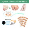 Professional Ingrown Toenail Treatment Set for Home Use
