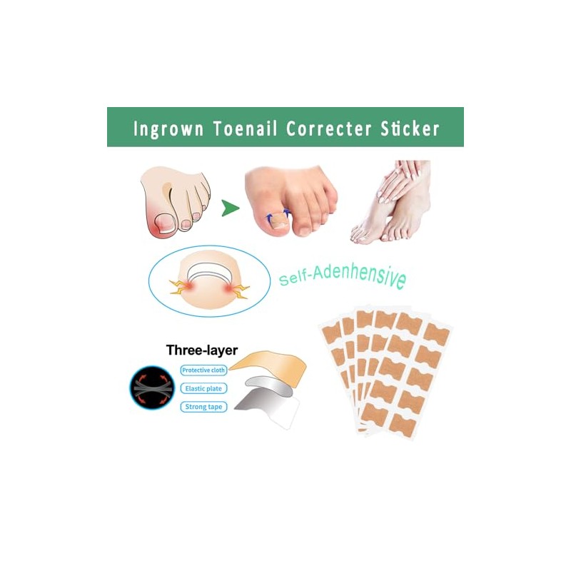 Professional Ingrown Toenail Treatment Set for Home Use
