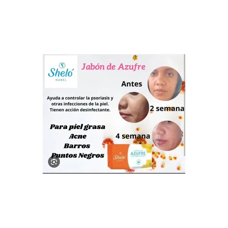 Olvídate Del Acné Y Ten Un Cutis Más Limpio