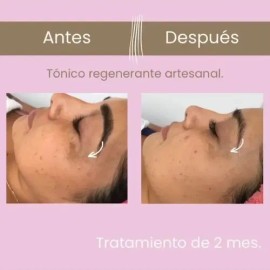 Tónico/serum Facial Regenerante 50ml Artesanal 100% Orgánico