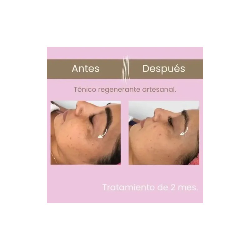 Tónico/serum Facial Regenerante 50ml Artesanal 100% Orgánico