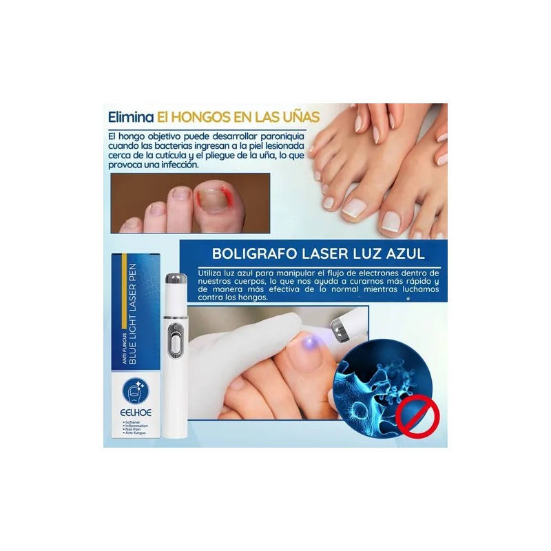 Pluma Luz Azul Elimina Hongo Cuidado Uñas Reparacion Láser F