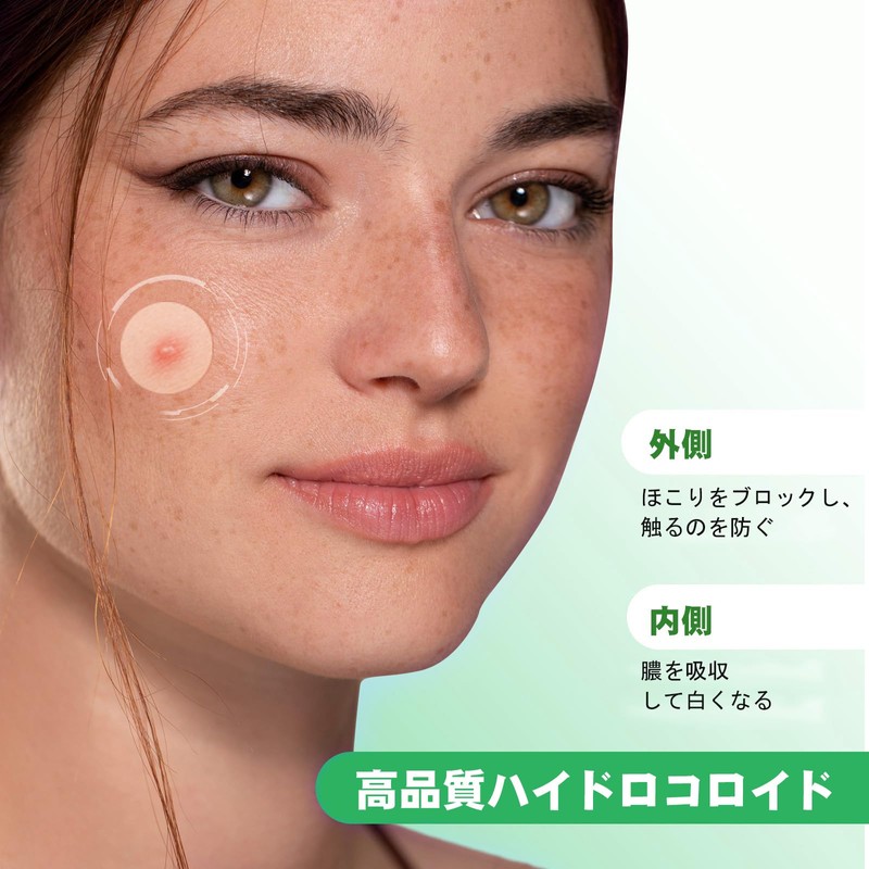 ACOTYE Pimple Patches, 245 Pieces, Acne Patches, Acne Patches, Tea
