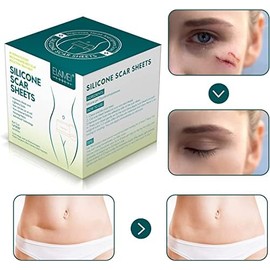 ZODENIS Hojas de silicona para cicatrices (rollo de 4 cm x 3m), rollo de cinta de silicona para cicatrices, tiras de silicona para cicatrices, reutilizables, hojas profesionales de eliminación de cicatrices para cesárea, cirugía, quemaduras, queloides, ac