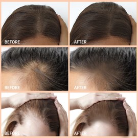 Boobeen Multi-purpose Hairline Shadow Powder Set, Root Touch Up Powder, Temporary Concealer Palette with Makeup Brush, Instantly Cover Up Hair Color