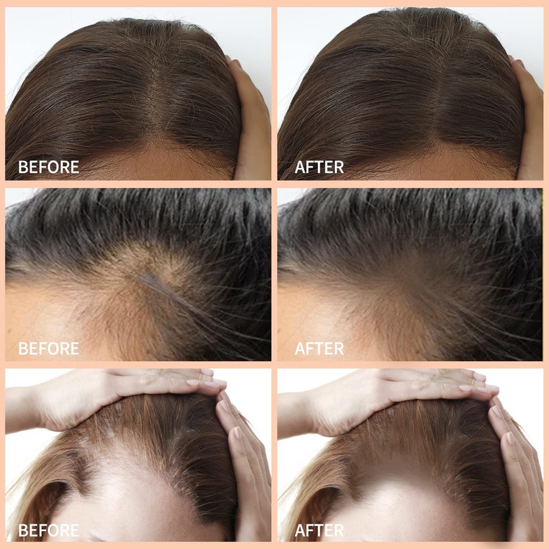Boobeen Multi-purpose Hairline Shadow Powder Set, Root Touch Up Powder,