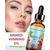 Botanical Beauty ROSEHIP OIL Pure Natural Refined Undiluted for Face,