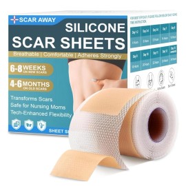 Unbranded Silicone Scar Tape, Medical Grade Silicone Scar Sheets (1.6” x 60” Roll - 1.5M),