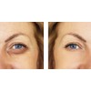 Verisol - Collagen Bioactive Peptides (Natural Collagen Powder) Made in