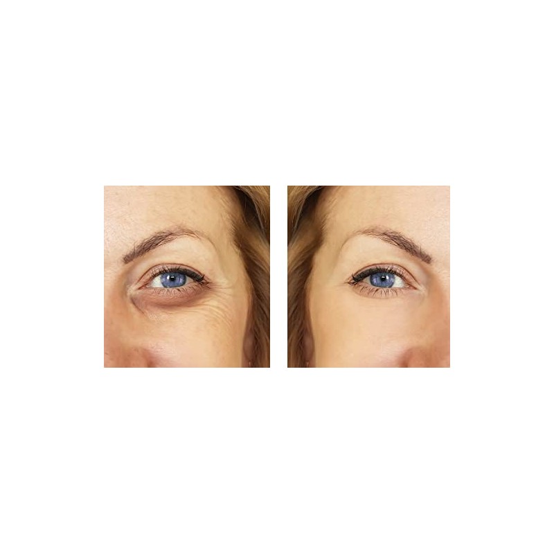 Verisol - Collagen Bioactive Peptides (Natural Collagen Powder) Made in