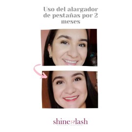 Kit Para Crecimiento De Pestañas