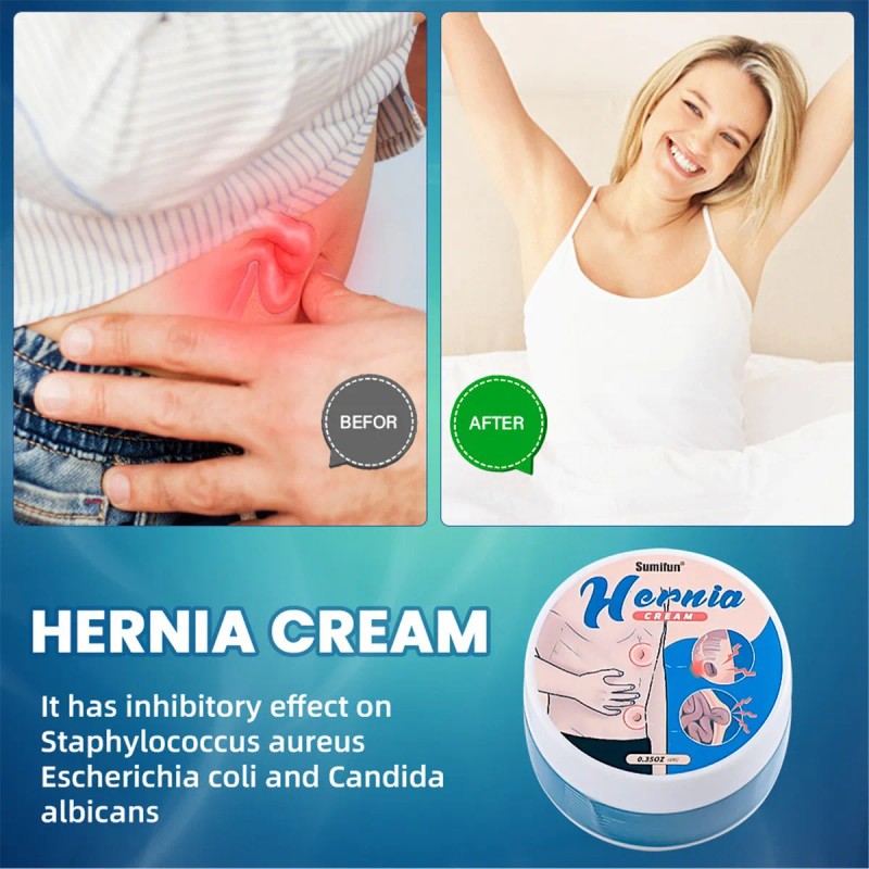 Crema Para Aliviar La Hinchazón En La Ingle