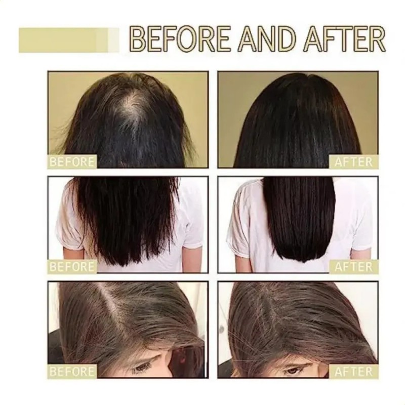 Aceite Esencial Para El Cuidado Del Cabello Con Plantas De