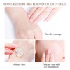 AICHUN BEAUTY Peeling Gel Face Body Removes Skin Aging Keratine