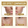 Crema Quitamanchas Hidratante 20g Para Rostro Todo Tipo De Piel
