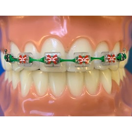 Snapcaps Braces Bumper Cover, Orthodontic Bracket Wax Substitute, Alternative Snap-on Braces Guard Braces Accessories 10 pack (Butterfly)