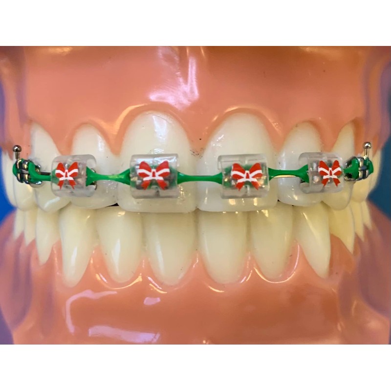 Snapcaps Braces Bumper Cover, Orthodontic Bracket Wax Substitute, Alternative Snap-on