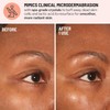 Dr. Brandt Advanced Microdermabrasion Face Exfoliator Travel Size - 0.7