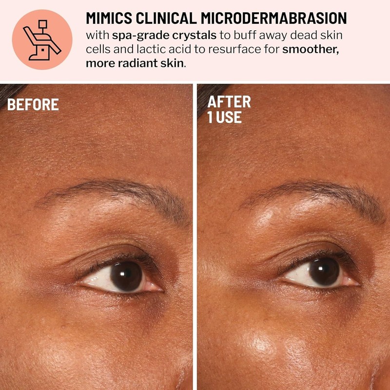 Dr. Brandt Advanced Microdermabrasion Face Exfoliator Travel Size - 0.7