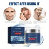Em Crema Para Ojos Para Hombre Quita Ojeras Arrugas, Retinol