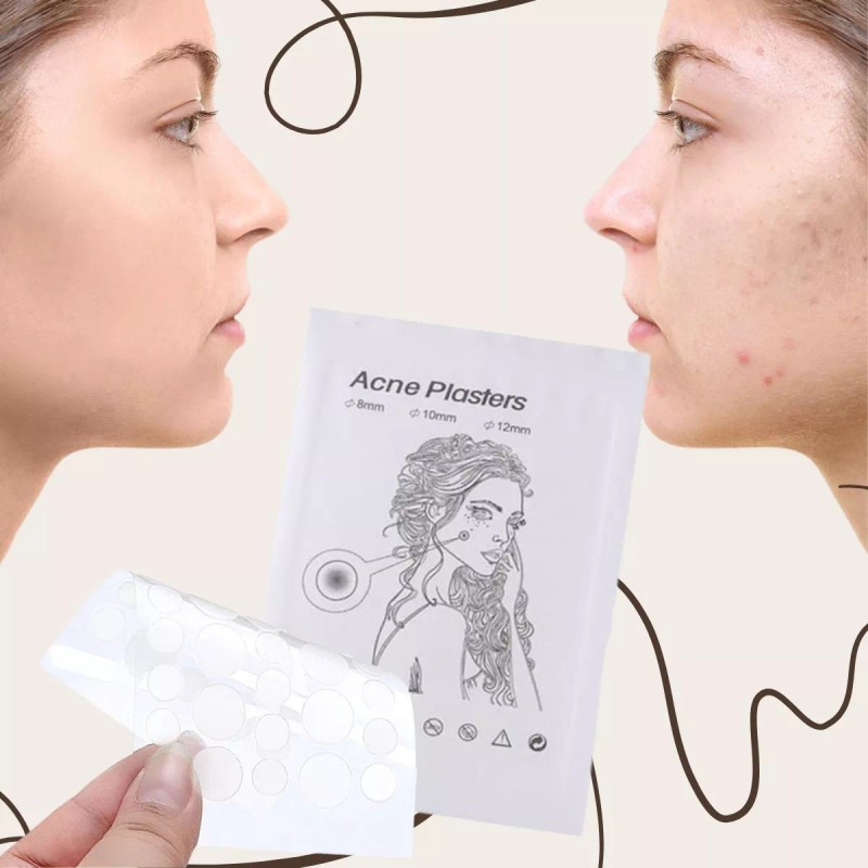 Veraly Parches Para Acné Espinillas Facial Absorbente Oculta