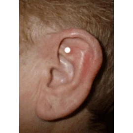 USA Seller Ear Acupressure To Lose Weight Magnets 1 New Kit 2024 Success