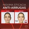 Oreal Paris Revitalift Laser Crema Día Triple Acción Anti Edad