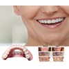 DENTUREWAY DIY Denture Kit with Impression(3 Sets of False Teeth),Do-It-Yourself