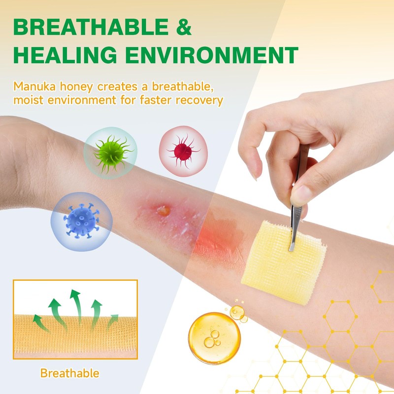 Manuka Honey Gauze Dressing, 4×4 Inches, 6 Individual Pack