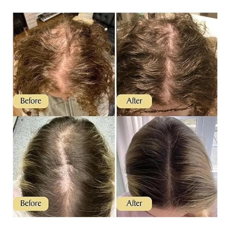 Aceite Capilar Veganoreparador De Daños Suavizante Nutritivo