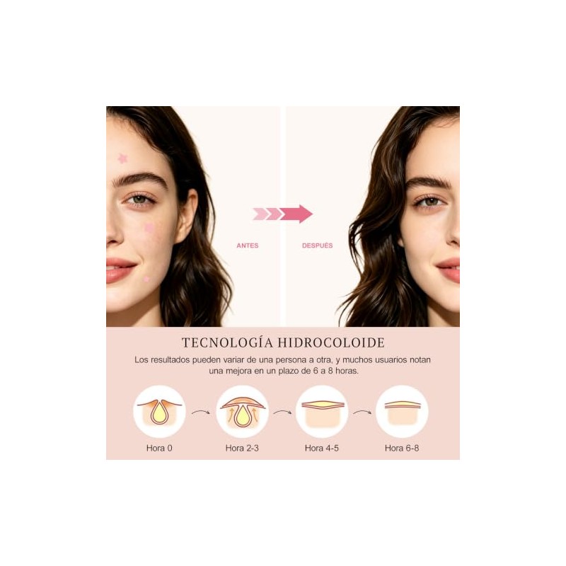 Parches para Acne 320 Piezas, Pimple Patch Estrellas para Granos