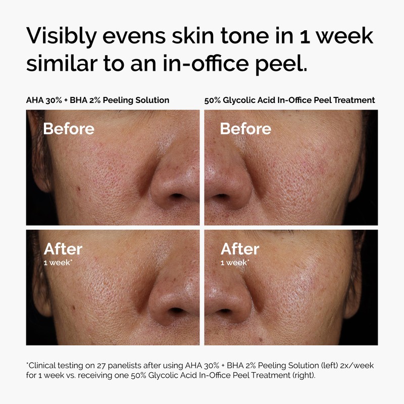 The Ordinary AHA 30% + BHA 2% Peeling Solution, Advanced