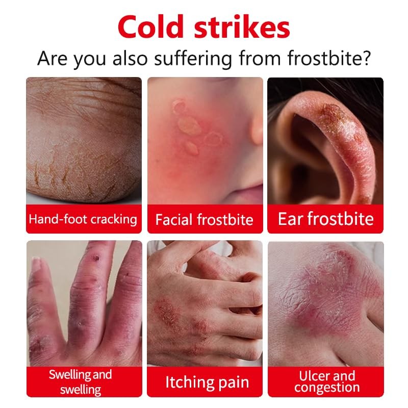 Verbrennungen auf pflanzenbasis und insektenstiche mit 100ml lotion