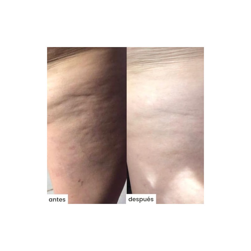 Kit para celulitis con Cepillo Azala Brush + cel-u +