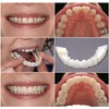 Adjustable Smile Supports - 2 Pairs (Top & Bottom) |