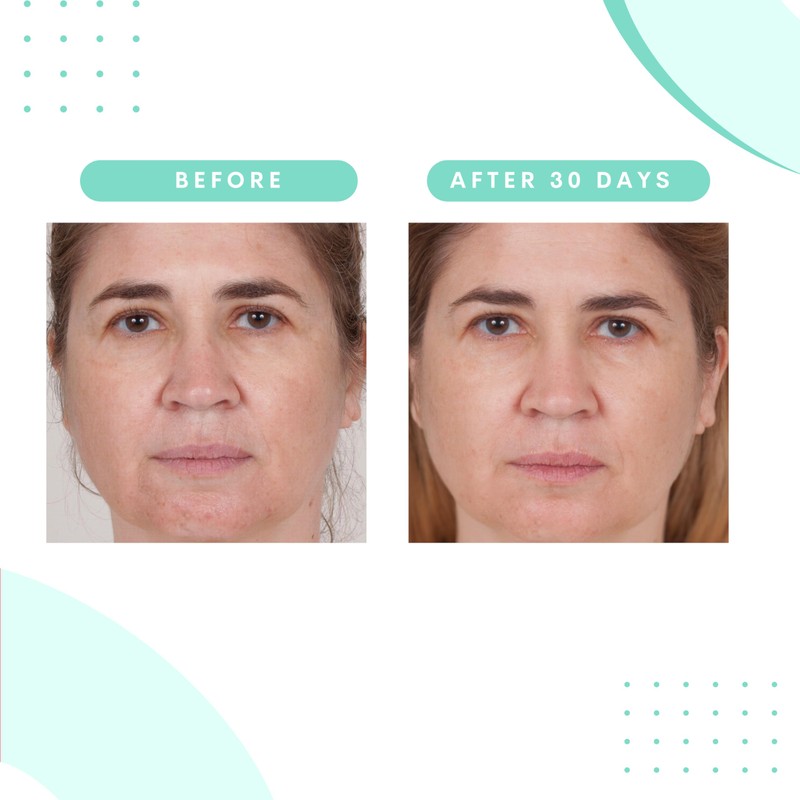 Serious Skincare Glycolic Cleanser - Daily Non-Drying Exfoliating Face Wash
