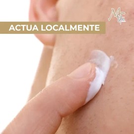 Crema Anti Acné, Control De Grasa, Reduce Manchas. Mc Life Tipo De Piel Todo Tipo De Piel