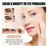 B Aclarar Ojeras, Bolsas Debajo De Los Ojos, Elásticas,