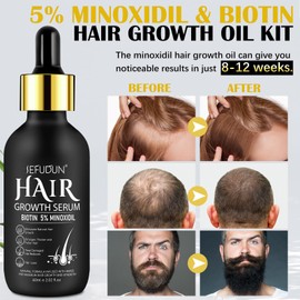 Beard Growth Kit with Titanium Derma Roller, Beard Growth Kit, Beard Growth Set with Beard Roller, Beard Growth Beard Oil, Stimulates the Growth of Hair and Beards for Christmas, Men's Gifts