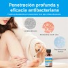 30ml Tratamiento De Uñas De Los Pies Infectadas Por Hongos