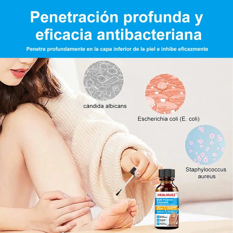 30ml Tratamiento De Uñas De Los Pies Infectadas Por Hongos