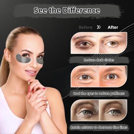 POSTA 20Pairs 40Pcs Collagen Eye Mask, Glitter Under Eye Patches for Dark Circles and Puffiness, Hydrating Eye Skincare Reduce Wrinkles and Fine Lines, Eye Gels Pads for Women and Men